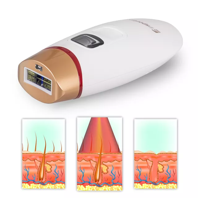 IPL-Epilierer inSPORTline Eriva