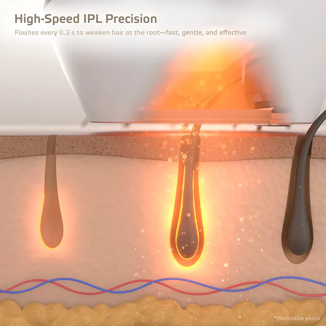 IPL-Epiliergerät inSPORTline Aphira